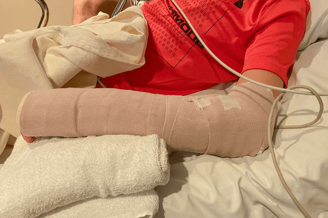 easton in a cast